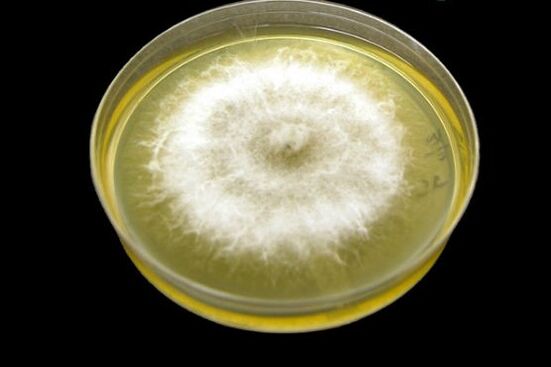 How to get rid of nail mold