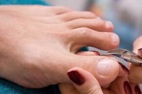 Pedicure as a way to infect nail fungus