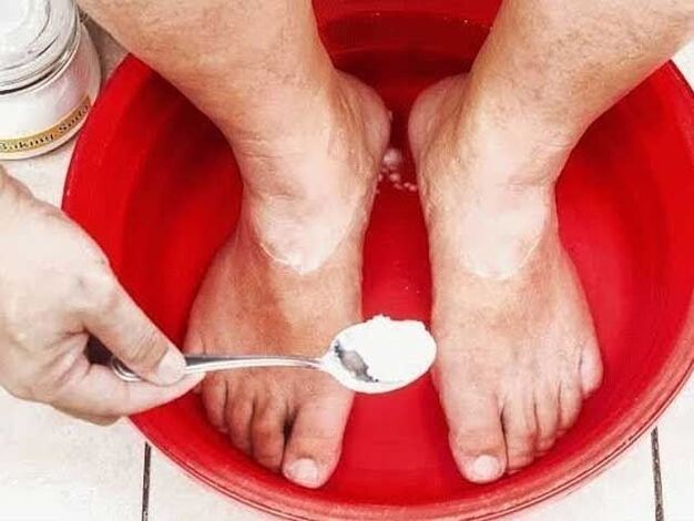 soda bath for fungus