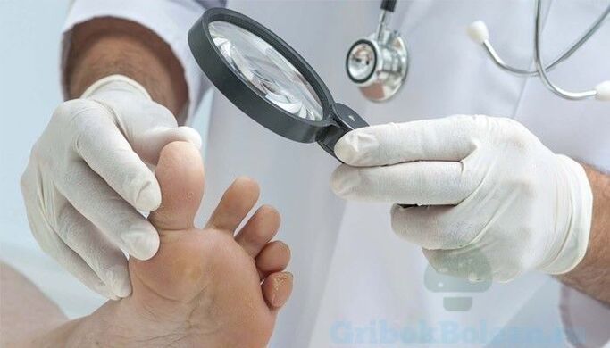 foot fungus diagnosis by a doctor