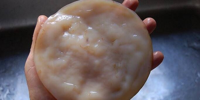Kombucha for nail fungus