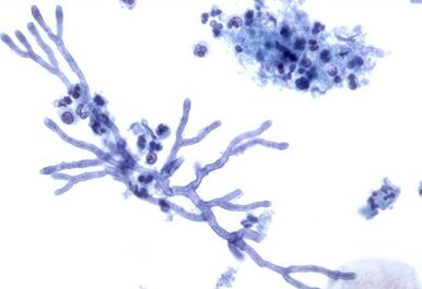 Mold mushrooms that affect nail plate